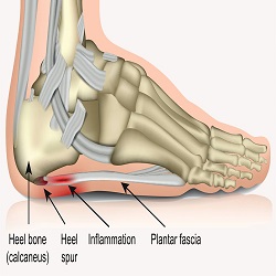 ឈឺចាប់ប្រអប់ជើង Foot Pain and Problems