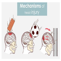 របួស​ក្បាល Head Injury