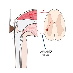 ណឺរ៉ូនម៉ូទ័រផ្នែកក្រោម Lower motor neurons