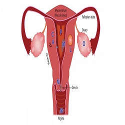 រដូវមិនទៀង Menstrual Disorders