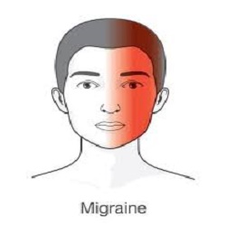 ឈឺក្បាលប្រកាំង Migraine Headaches