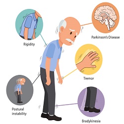 ជំងឺផាកឃីនសុន Parkinson's Disease